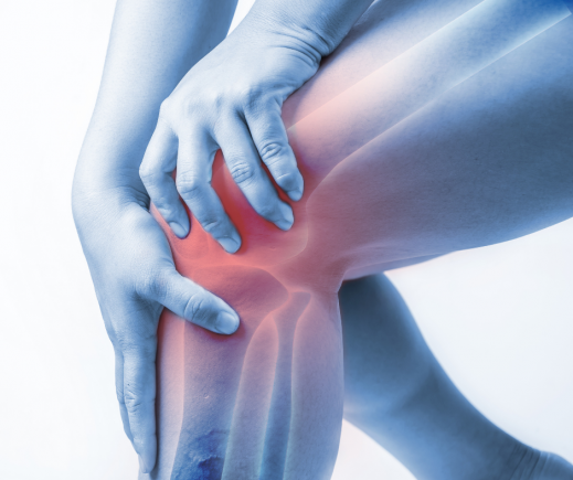 knie-color.png